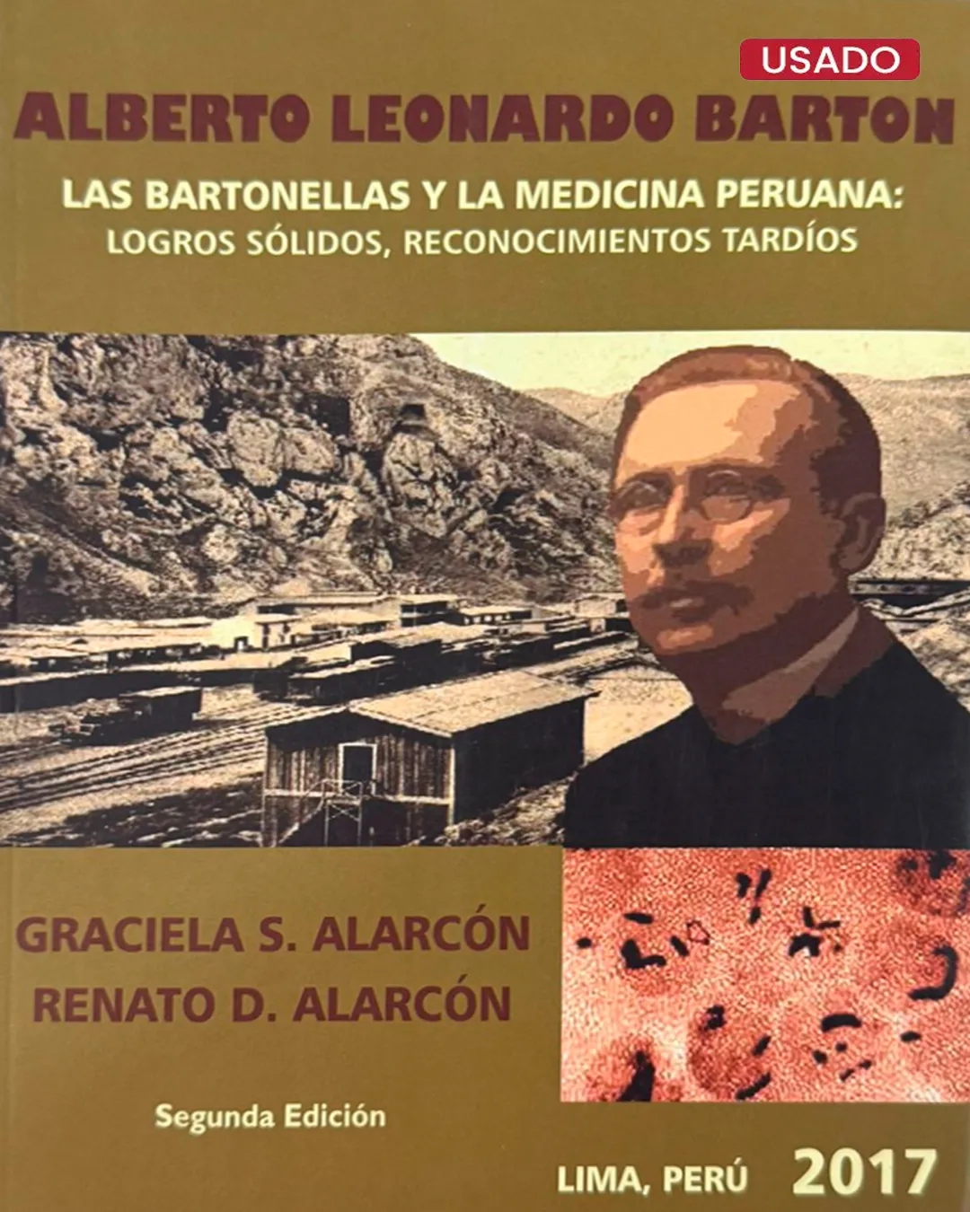 ALBERTO LEONARDO BARTON: LAS BARTONELLAS Y LA MEDICINA PERUANA: LOGROS SÓLIDOS, RECONOCIMIENTO TARDÍOS