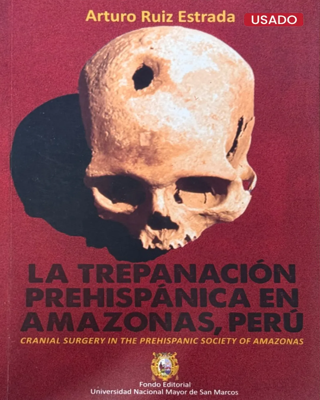 LA TREPANACIÓN PREHISPÁNICA EN AMAZONAS, PERÚ